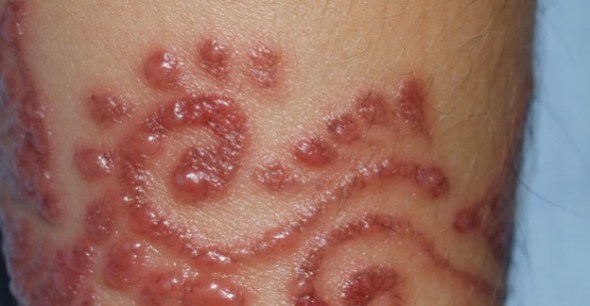 2 (entrevista - artes) Mehandi (1508) (bg)